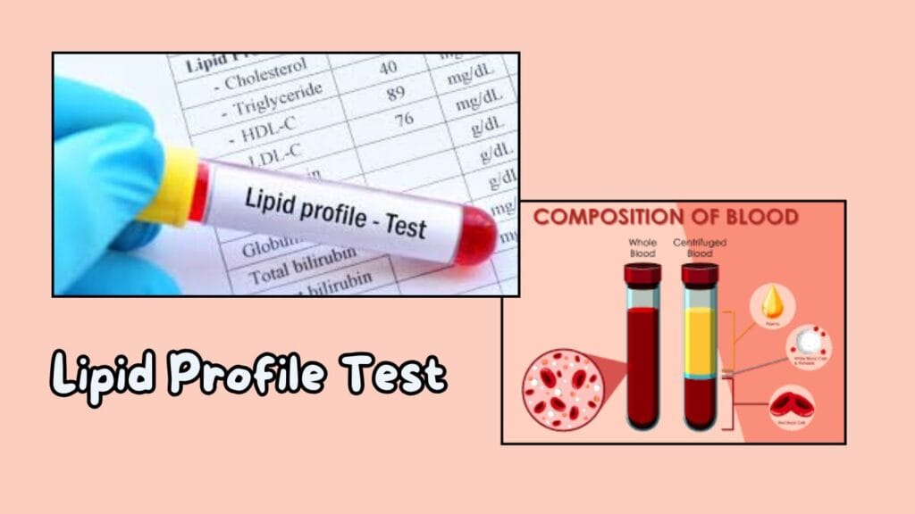 Lipid Profile Test